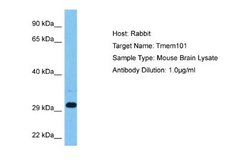 TMEM101 Rabbit anti-Mouse, Polyclonal, Novus Biologicals 0.1ml; Unconjugated:Antibodies,